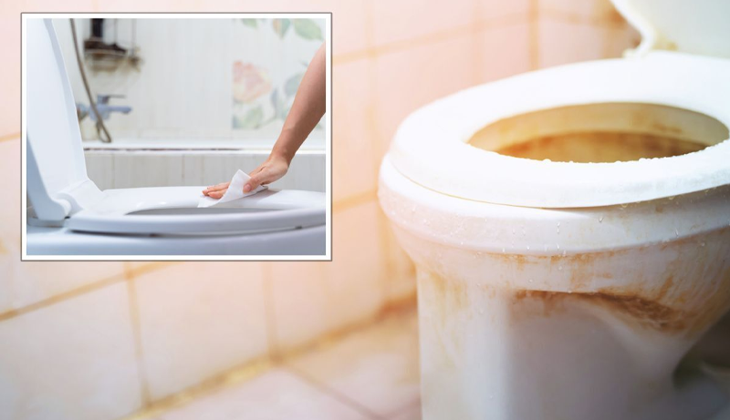 How To Remove Yellow Stains From Toilet Seat